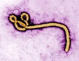 Dr Filipecka o eboli